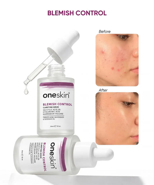Blemish Control Salicylic Acid 2% + Marrubium Valgare - 30ml