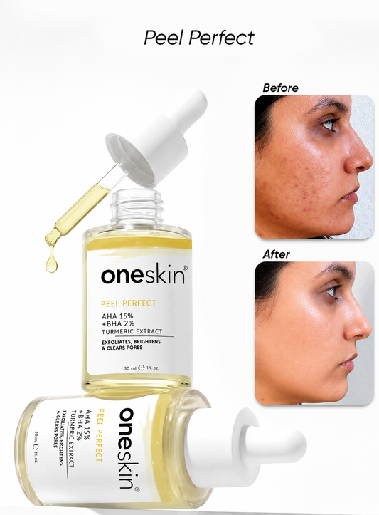 Peel Perfect AHA 15% + BHA 2%, Turmeric Extract - 30ml