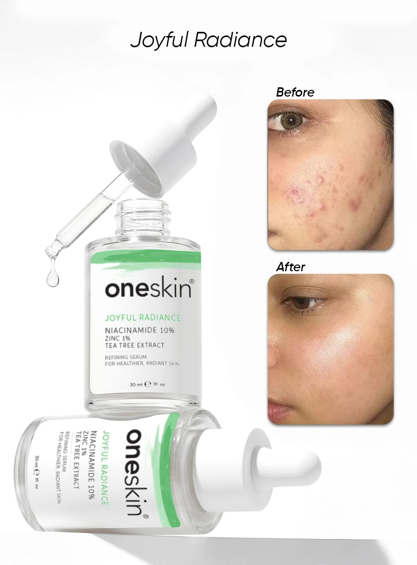 Joyful Radiance - Niacinamide 10%, Zinc 1%, Tea Tree Extract - 30ml